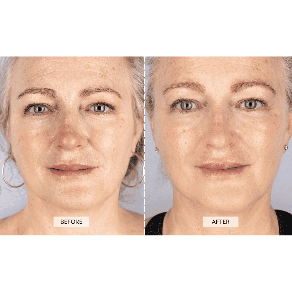 CurrentBody Skin Face & Neck Kit (worth 668€) - Black Friday Offer - Image 5