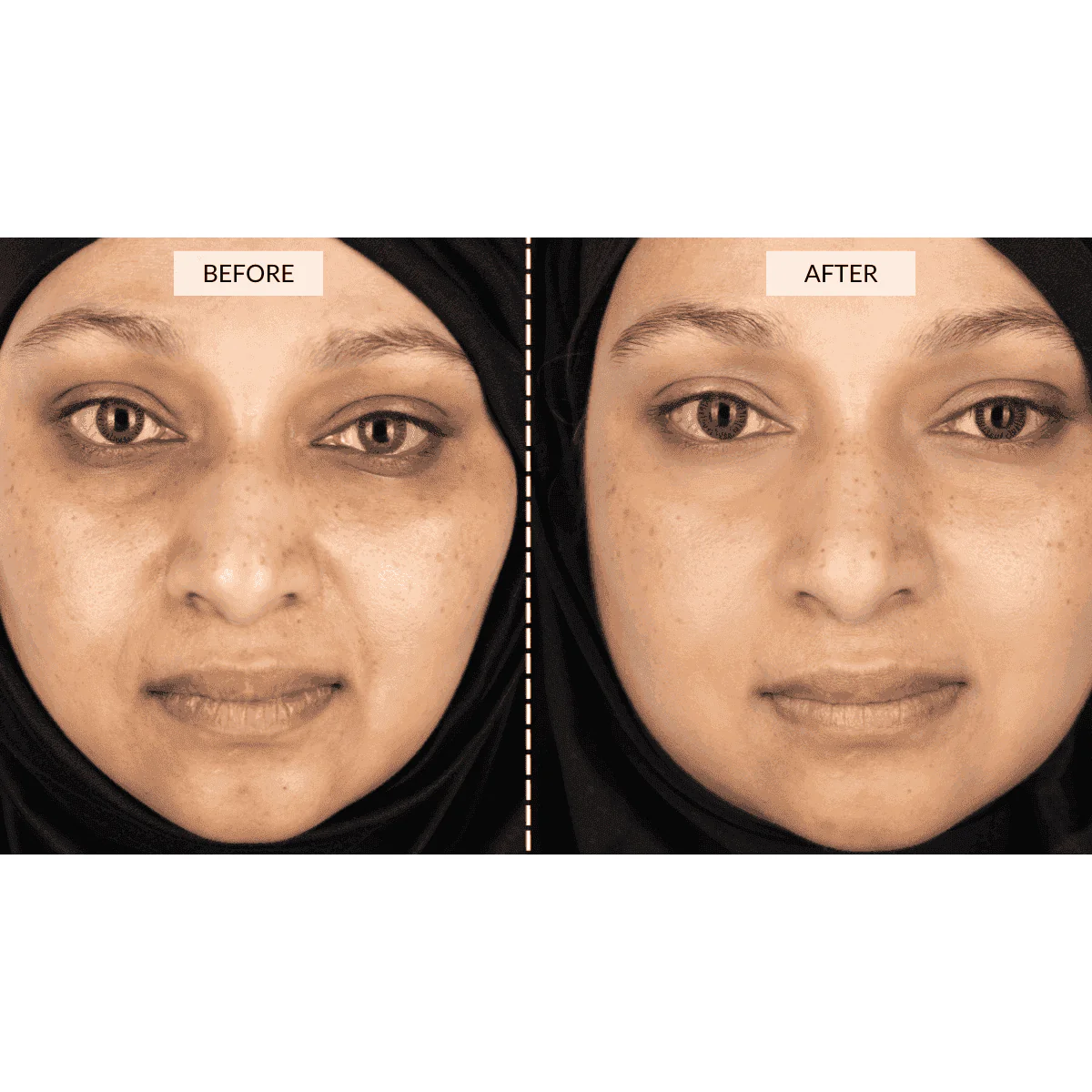 CurrentBody Skin Face & Neck Kit (worth 668€) - Black Friday Offer - Image 6