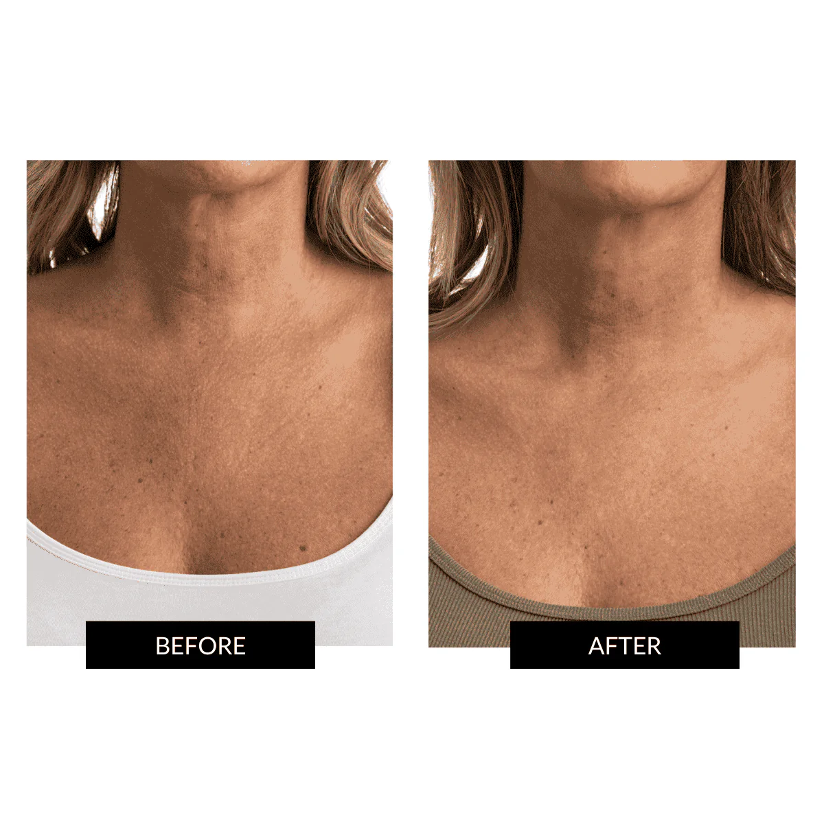 CurrentBody Skin Face & Neck Kit (worth 668€) - Black Friday Offer - Image 7