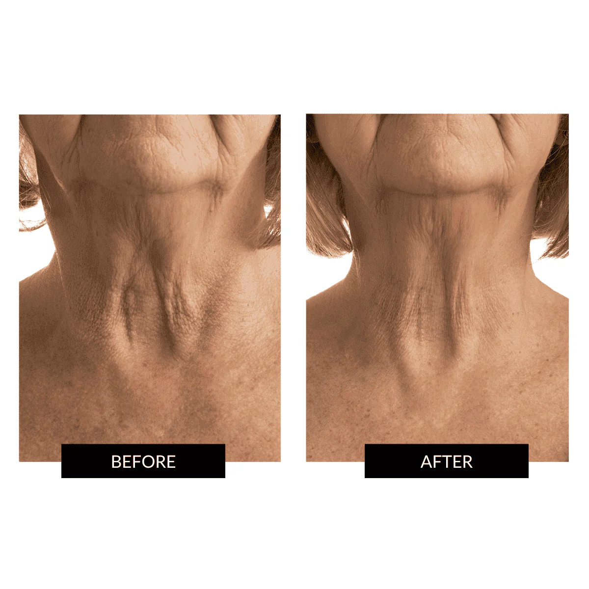 CurrentBody Skin Face & Neck Kit (worth 668€) - Black Friday Offer - Image 8