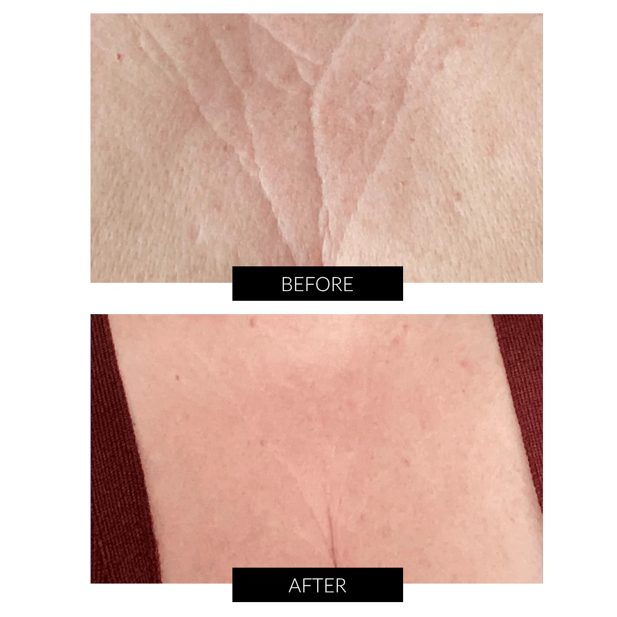 CurrentBody Skin Hals & Dekolleté Perfector Angebot - Image 7