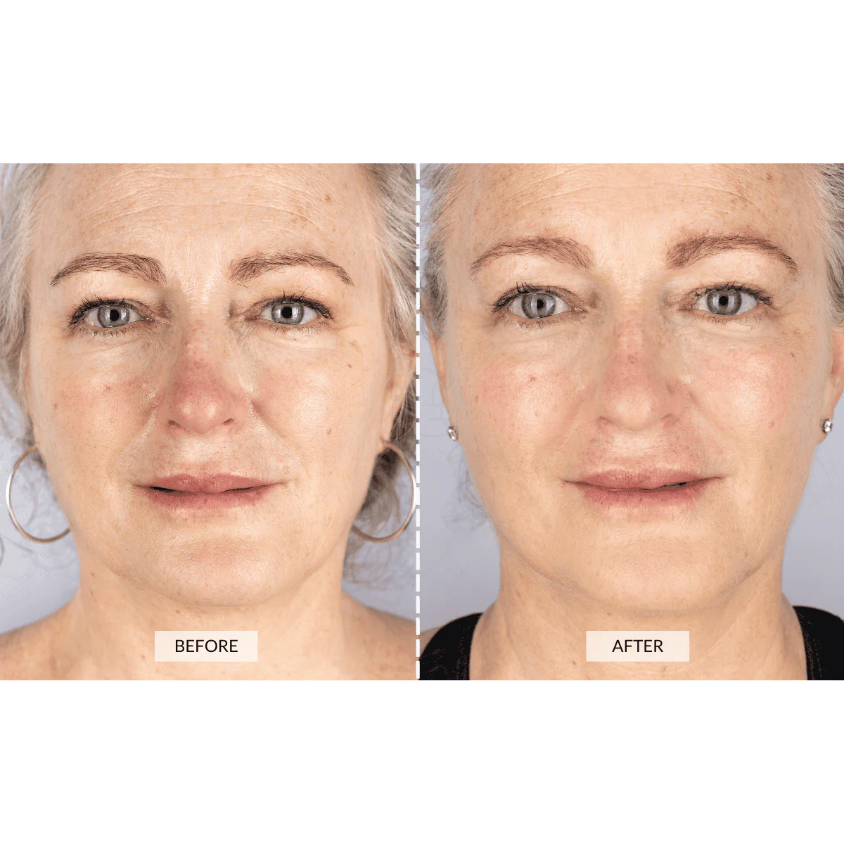 CurrentBody Skin LED Lichttherapie Maske Angebot - Image 5