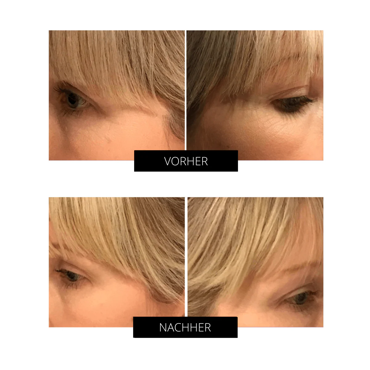 OXYjet GO-Sauerstoff-Gesichtsbehandlungssystem - Image 3