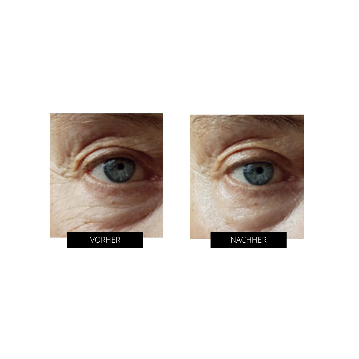 OXYjet GO-Sauerstoff-Gesichtsbehandlungssystem - Image 7